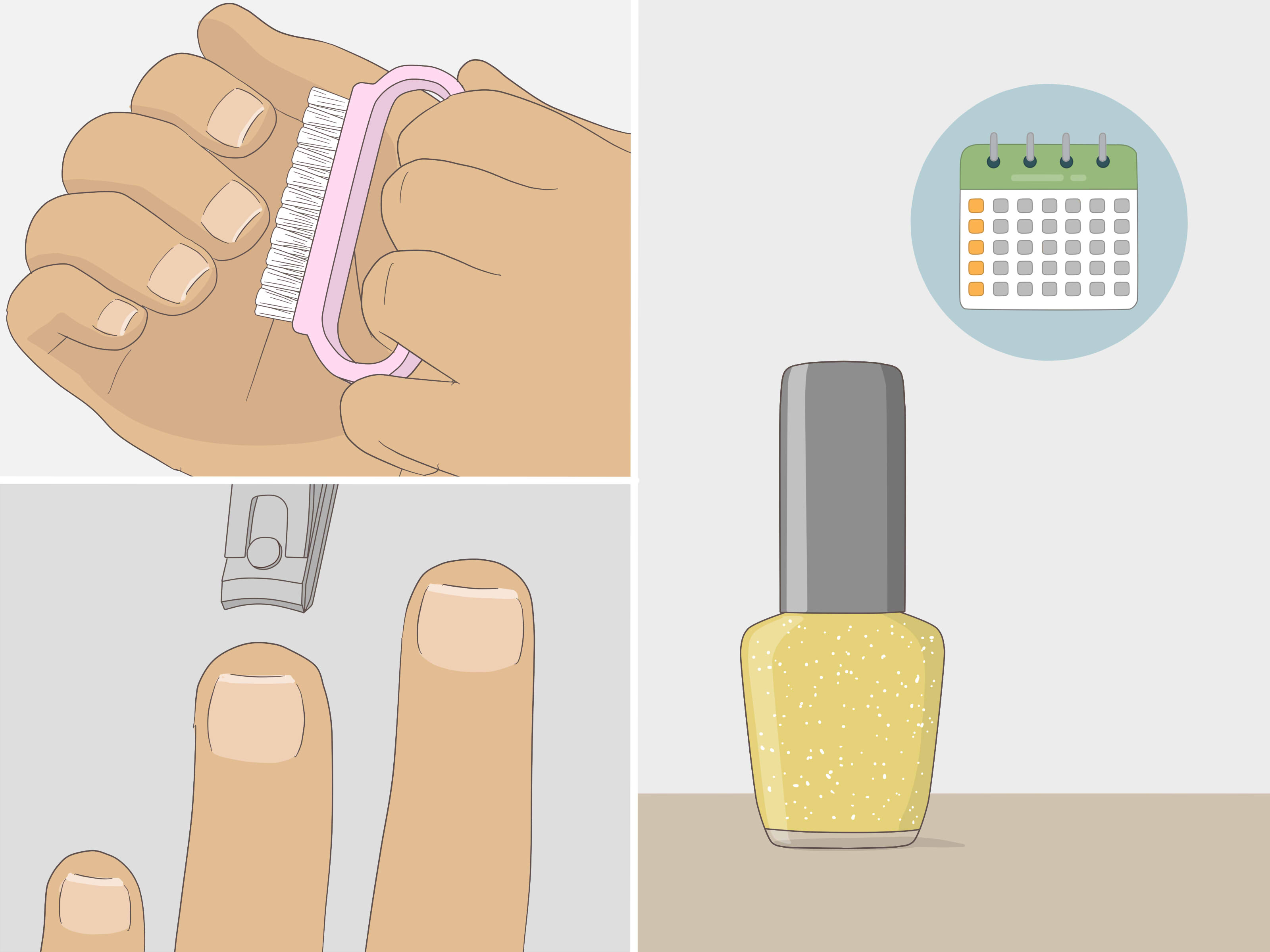 1. Como a Terbinafina age contra fungos nas unhas?
2. Guia completo sobre o uso de Loceryl para micose.
3. Terapia a laser: a nova fronteira no tratamento de fungos nas unhas.
4. Remédios caseiros para fungos nas unhas: o que realmente funciona?
5. Higiene e prevenção: como evitar a reinfecção por fungos nas unhas.