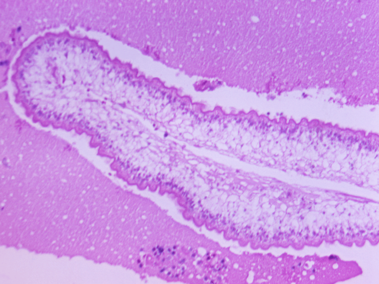 5 ideias de títulos:
1. Albendazol: O Guia Completo para Tratamento de Verminoses
2. Como Usar Albendazol Corretamente: Dicas e Orientações Médicas
3. Albendazol para Crianças: Segurança e Dosagem Adequada
4. Precauções com Albendazol: Quem Não Deve Usar e Por Quê
5. Albendazol vs. Outros Antiparasitários: Qual a Melhor Opção?