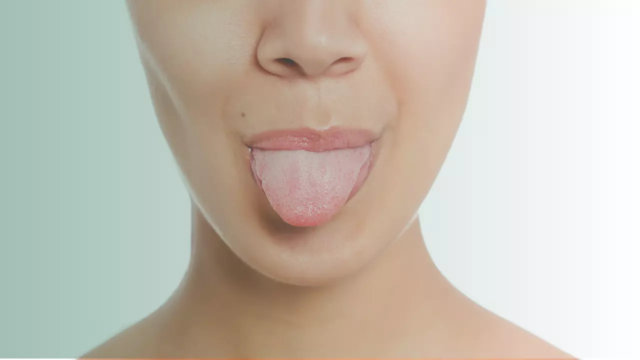 Aftas Recorrentes: Entenda as Causas e Descubra Como Preveni-las