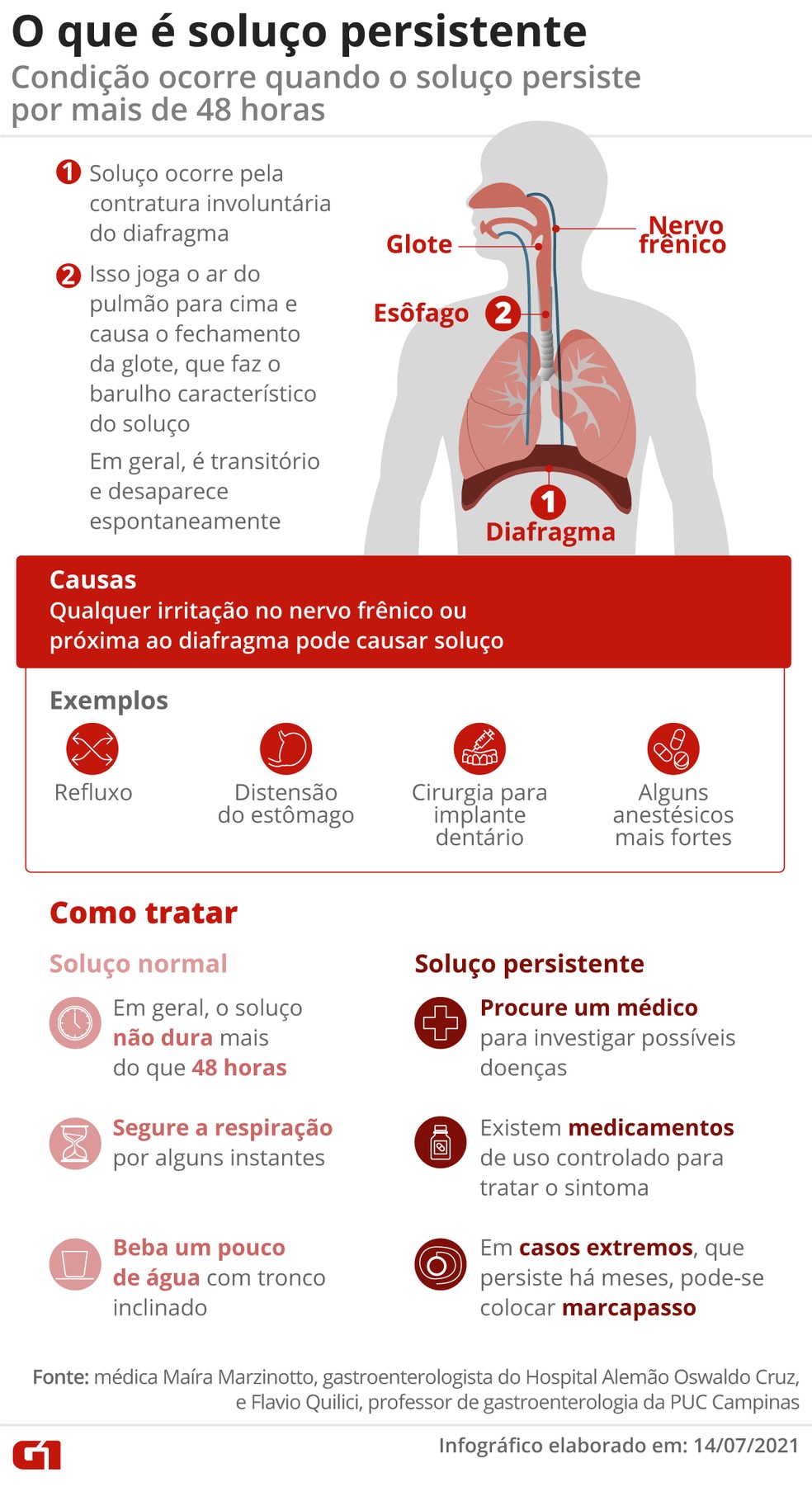5 Técnicas Infalíveis para Parar o Soluço em Minutos