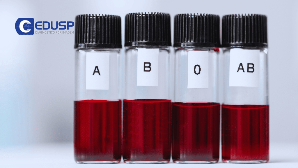 5 ideias de títulos:
1. Descubra seu Tipo Sanguíneo: Um Guia Completo
2. Tipagem Sanguínea: O Que Você Precisa Saber
3. Doação de Sangue: Salve Vidas e Conheça Seu Tipo Sanguíneo
4. Onde Encontrar Informações Sobre Seu Tipo Sanguíneo
5. Mitos e Verdades Sobre a Tipagem Sanguínea