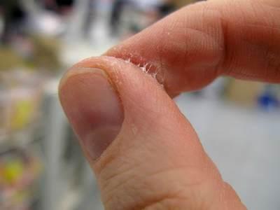 5 Dicas Infalíveis para Remover Super Bonder dos Dedos
Como Tirar Super Bonder da Pele Rapidamente
Acetona vs. Métodos Naturais: Qual o Melhor para Remover Super Bonder?
O Que Fazer em Caso de Super Bonder nos Olhos ou Boca?
Guia Completo: Removendo Resíduos de Super Bonder com Segurança