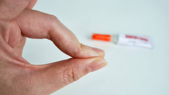 tirar super bonder do dedo