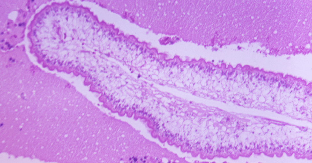 Diferenças entre Albendazol em Comprimido e Suspensão Oral